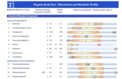 organic acids test