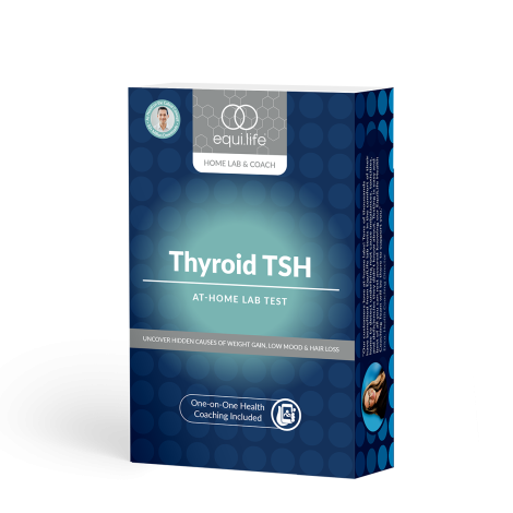 Thyroid TSH Test