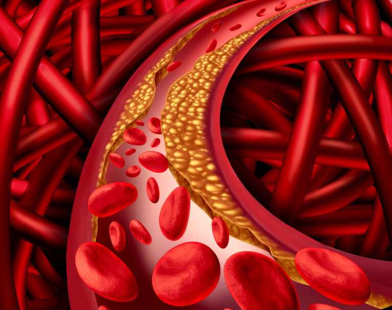 Can Nattokinase Replace Statins? The Science Behind Cholesterol